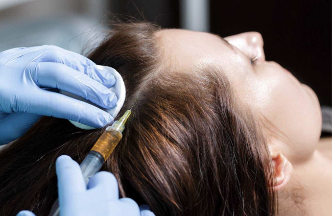 Stem Cell Hair Loss Therapy Medi Spa Cotswolds Gloucestershire