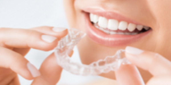 6 month smile invisalign dentistry straight teeth smile makeover Dentist Ceramic Centre